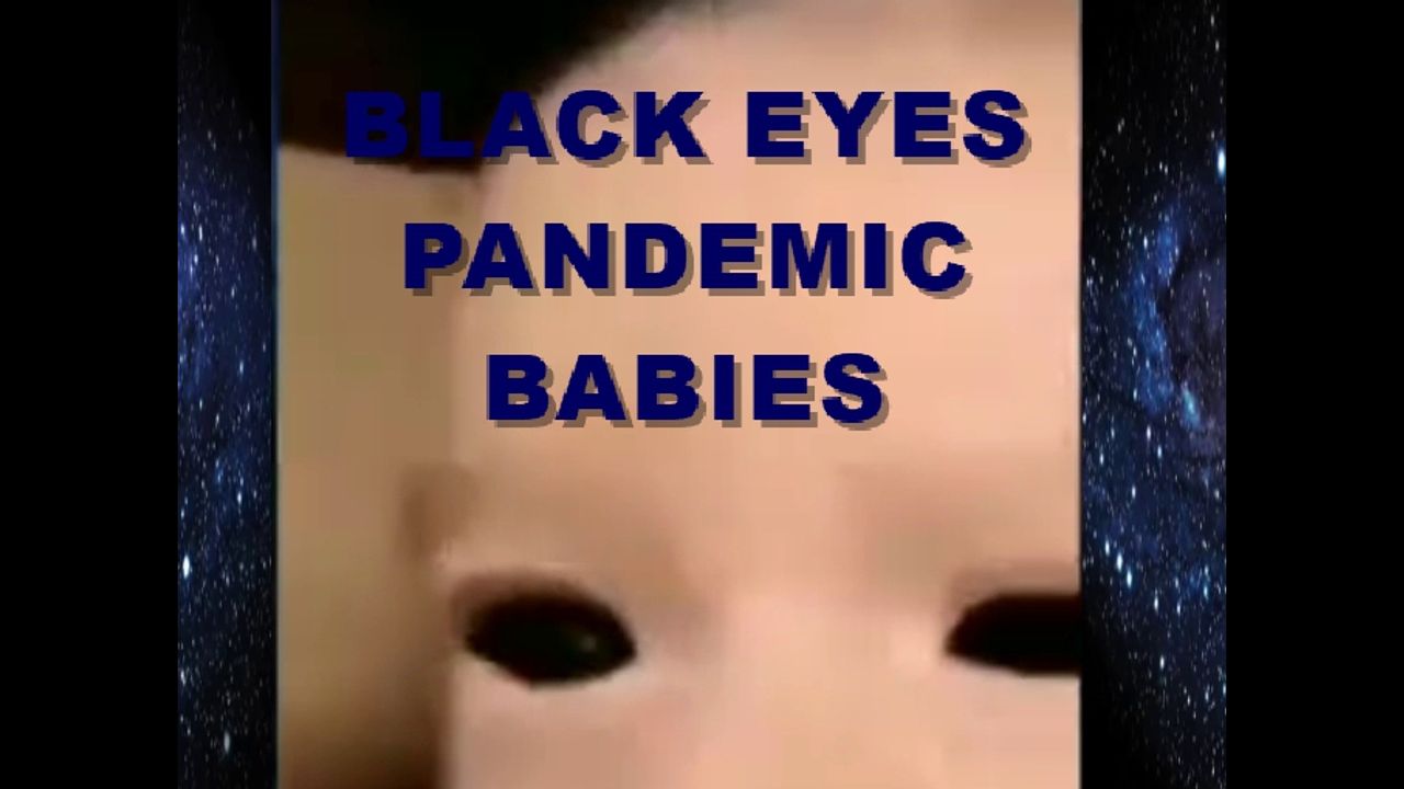 PANDEMIC Babies - some with Black Eyes